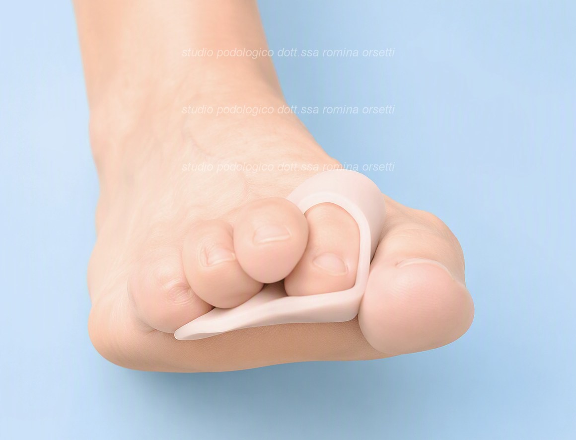 Ortesi digitale in silicone