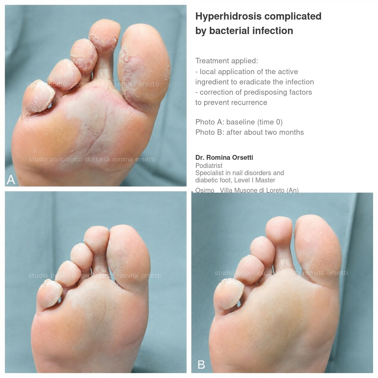Podiatric dermatology &ndash; photo 1