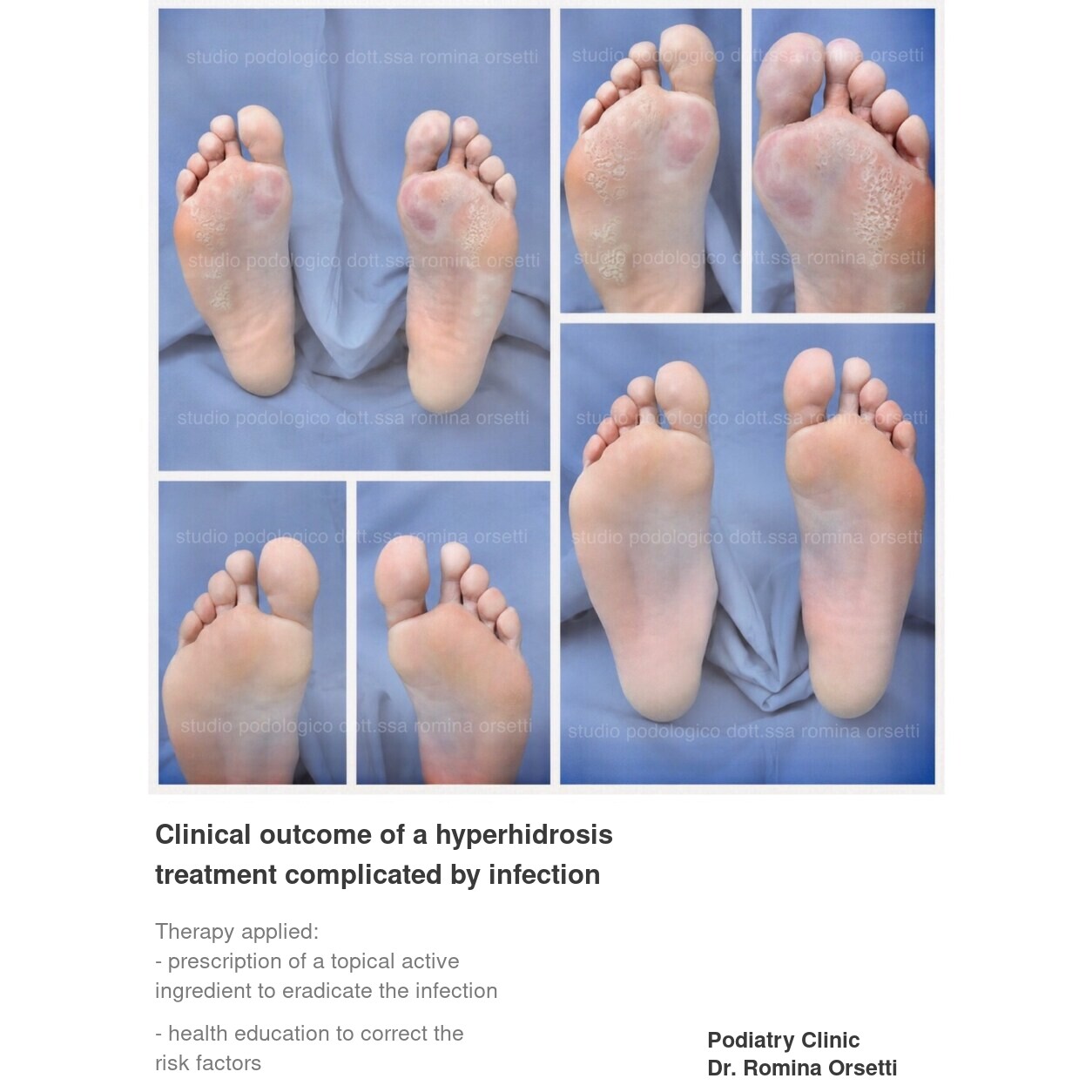 Podiatric dermatology &ndash; photo 2