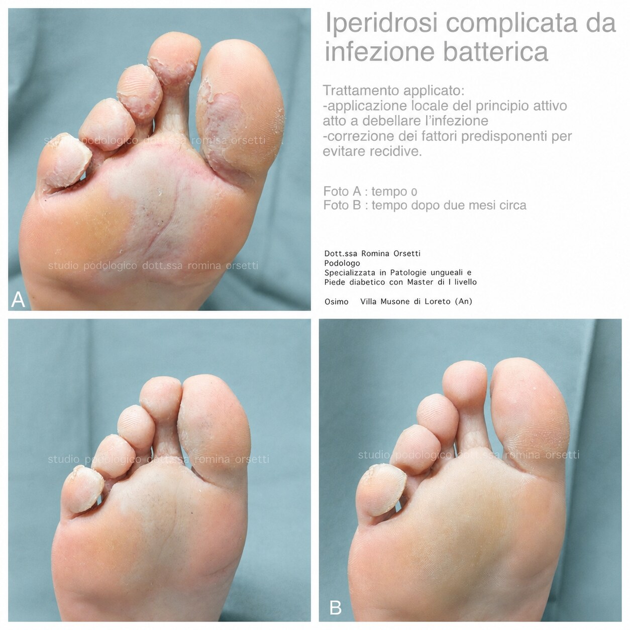 Dermatologia podologica &ndash; foto 1