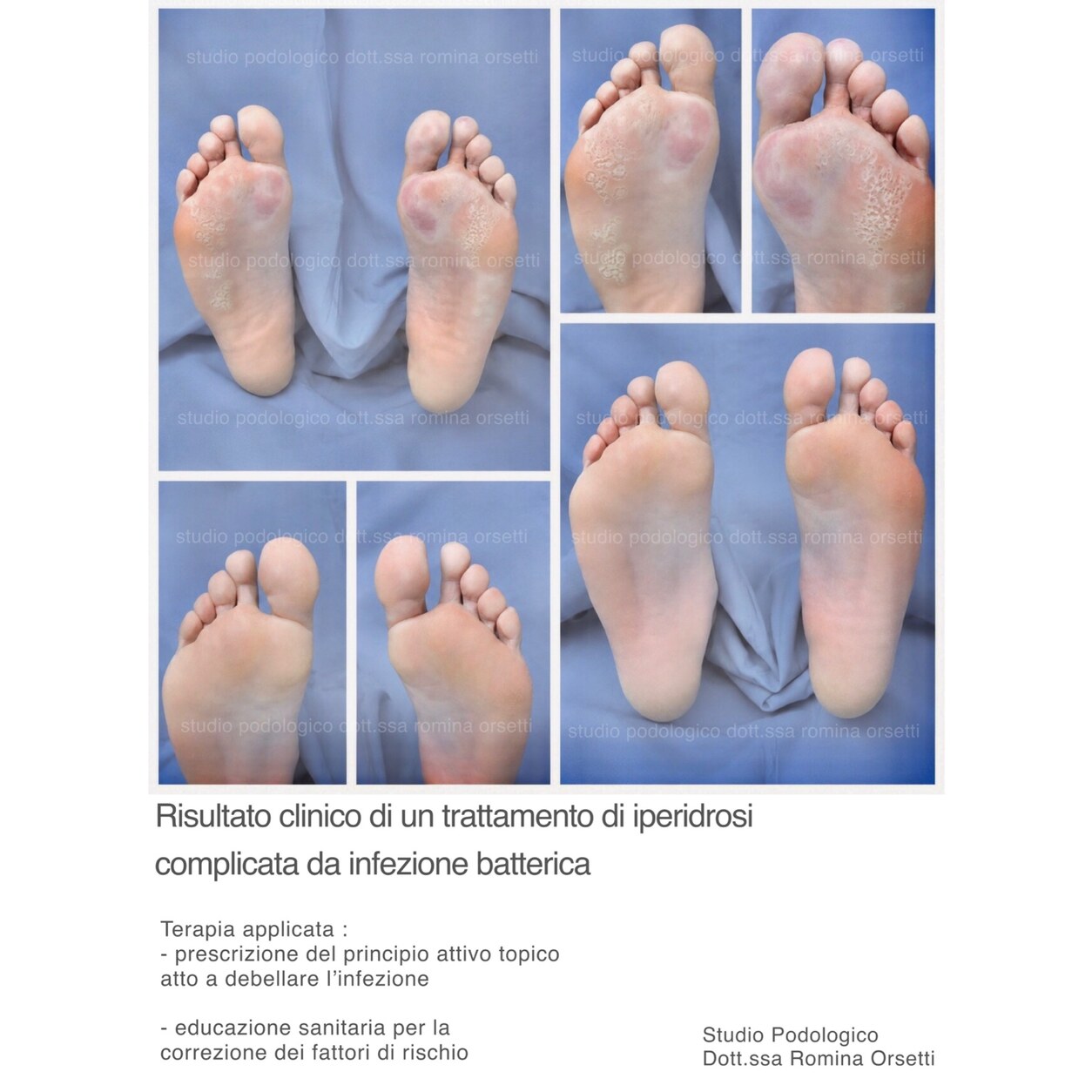 Dermatologia podologica &ndash; foto 2