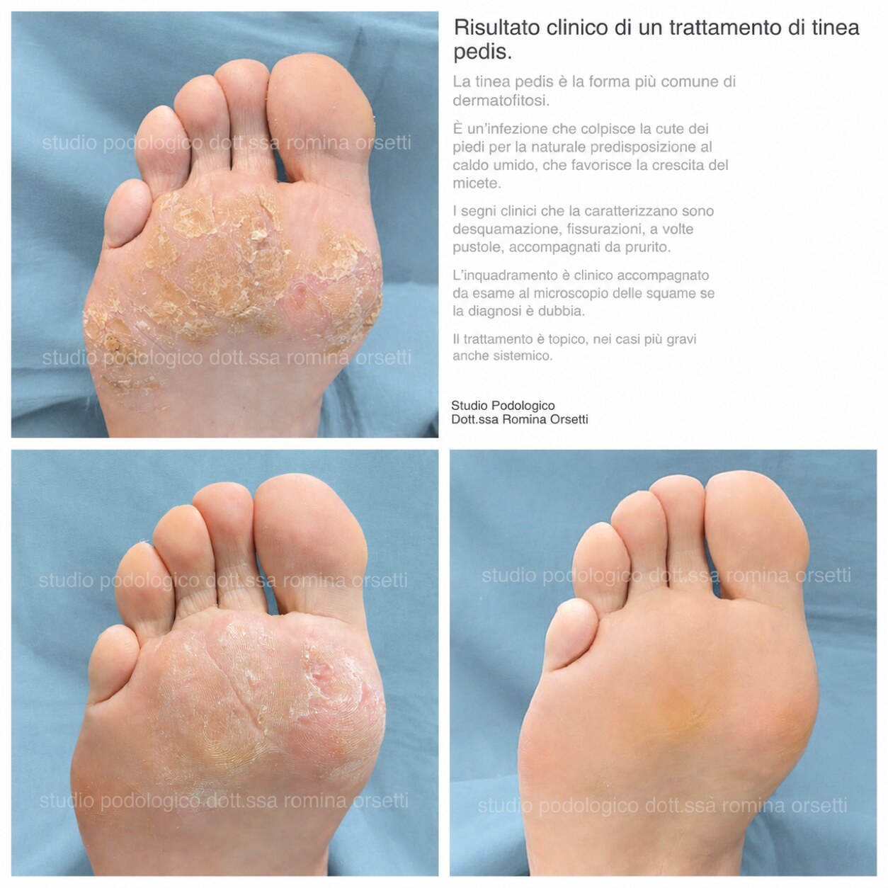 Dermatologia podologica &ndash; foto 3