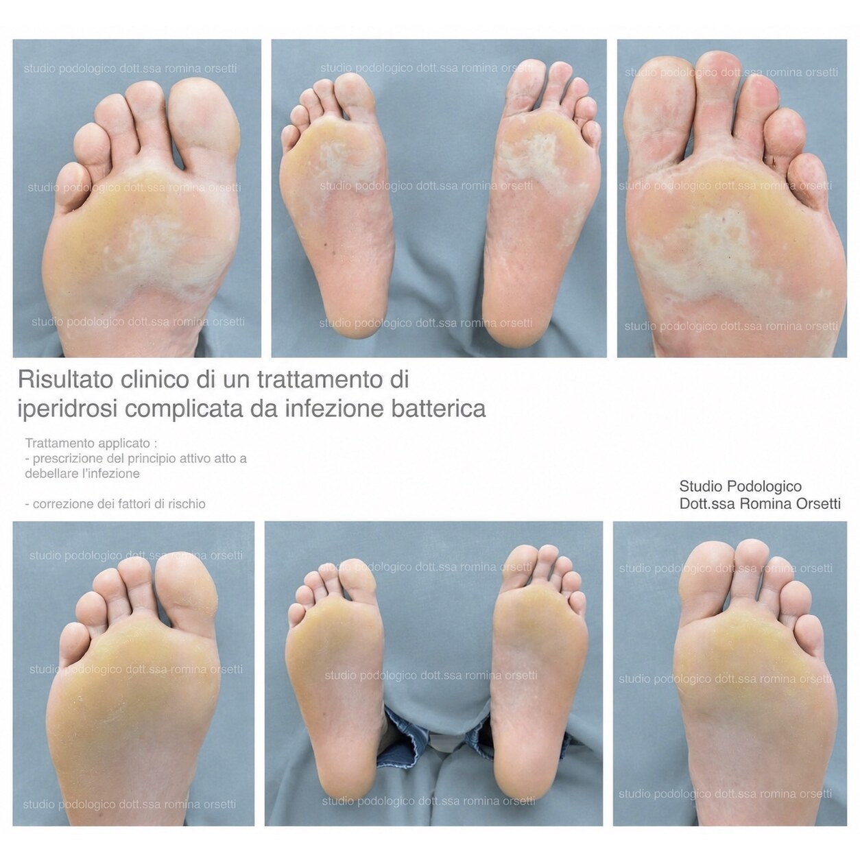 Dermatologia podologica &ndash; foto 4
