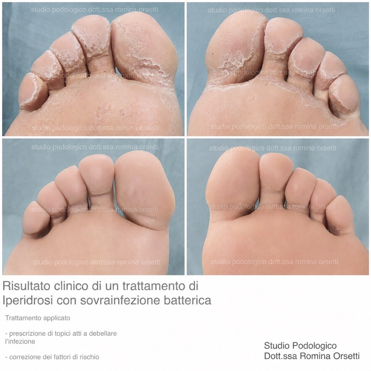 Dermatologia podologica &ndash; foto 5