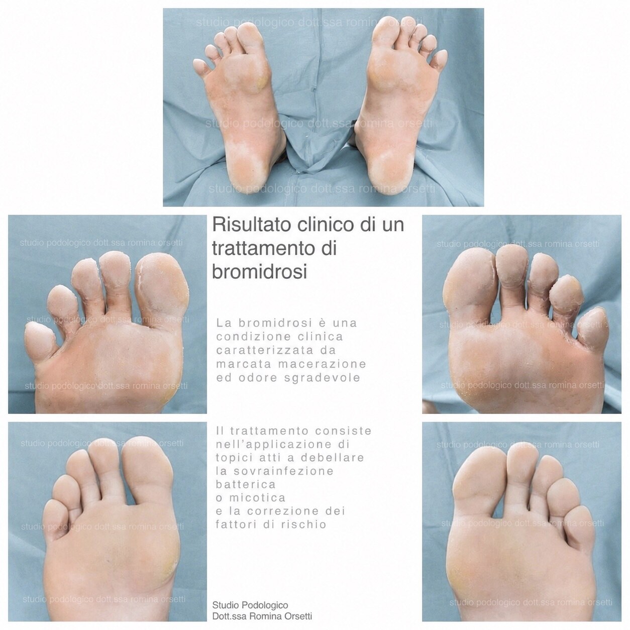 Dermatologia podologica &ndash; foto 6