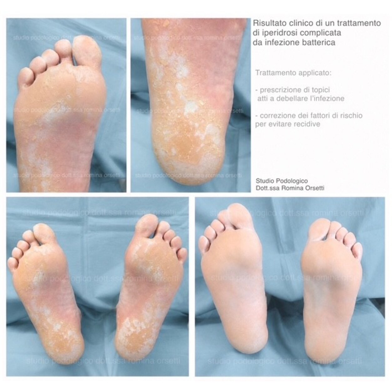 Dermatologia podologica &ndash; foto 7