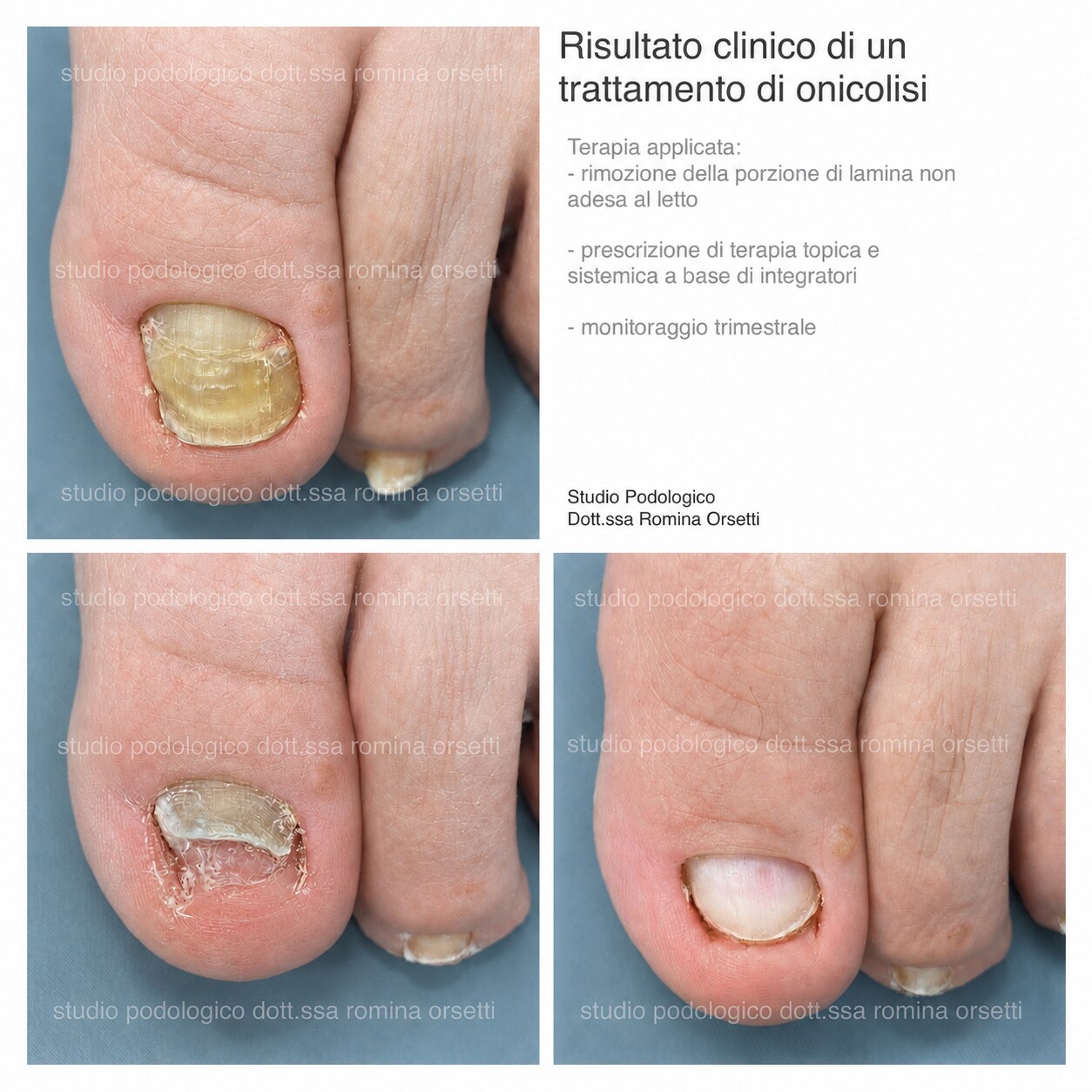 Onicolisi &ndash; foto 1